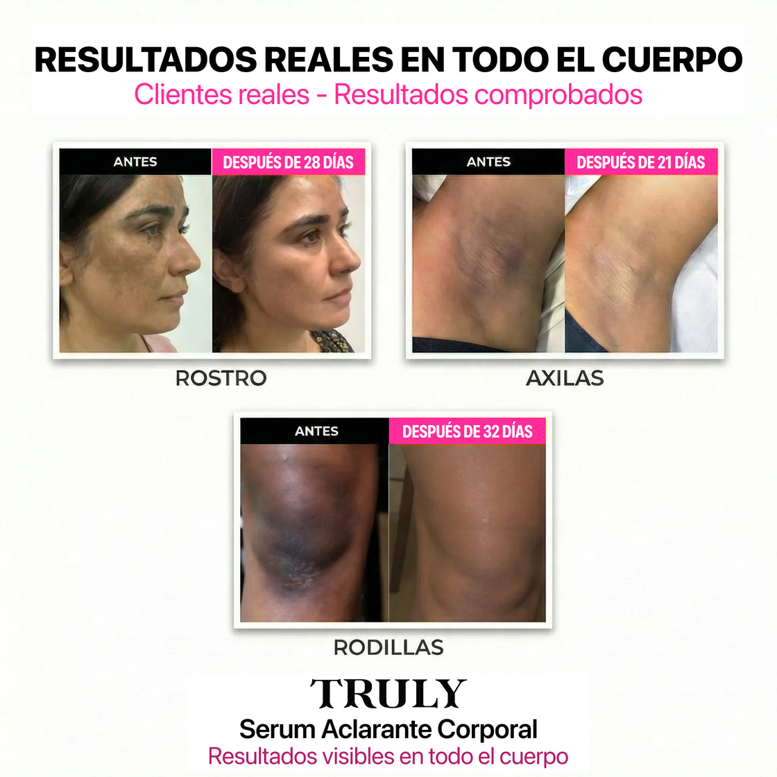 Serum Aclarante Corporal - Truly
